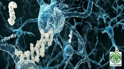 Dopamine deficiency may be major cause of memory loss in Alzheimer’s, new study reveals