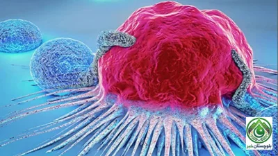 Obesity may be a major cause of rising cancer cases among young people, study reveals